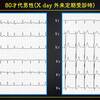 ECG-270：80才代男性。安定外来通院中です。