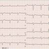 ECG-168：answer