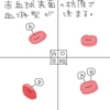 輸血の不規則抗体検査・クロスマッチ(交差適合試験)とは？採血が別々の理由もわかりやすく解説！