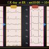 ECG-294：answer