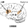 じじぃの「人の死にざま_1671_カール・ウェルニッケ（神経学者）」