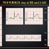 ECG-269：answer