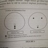 インプラントには３つのドットがあることがあります。