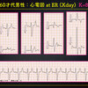 ECG-343：answer