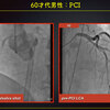 ECG-335：answer