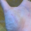 粗忽者の傷