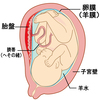 【出産】高位破水に気づかず2日間も放置してしまった話。感染症の危険あり！