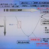 精神医学シリーズ2-2 うつ 2