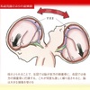 乳幼児揺さぶられ症候群は科学的根拠がなかったとしても保護者には知っておいてほしい