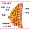 069【日本人女性の半数以上はマンモグラフィが役に立たない！？ 「高濃度乳房」とは？】がん（その１０）