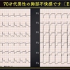 ECG-240：70才代男性。胸部不快感が続きます。