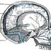 脳静脈洞血栓症（CVT）の総説
