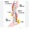 子供の成長痛の理由と対策