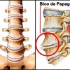 Conviver Sem Candidíase Em qual lugar Conseguir