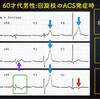 ECG-200：answer