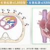 【コラム-138】：ECG Yellow web Book-003-PVCをやっつけろ!!-その1】📕→📘→📙