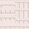 ECG-140：answer