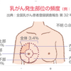 人間ドックで、乳癌見つかった。