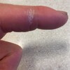 手指のカサカサ感。