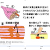指にある小さな塊が痛い