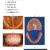 113回　義歯振り返り　術後管理編