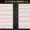 ECG-237：answer