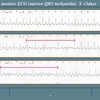 【ECG-410】answer