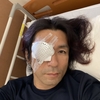 白内障 (超急性) 手術