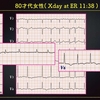 ECG-310：answer