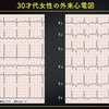 ECG-233：30台女性。一発診断を、お願いします。