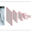 臨床現場で使われるAIを作る: 胸部X線診断AIの事例と医療画像分類の特徴