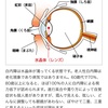 白内障と言われて…。