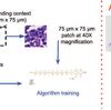 Artificial Intelligence–Based Breast Cancer Nodal Metastasis Detection