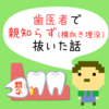 歯医者で親知らず(横向き完全埋没)を抜いた話