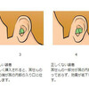 耳栓のつけ方（耳栓が耳穴にフィットしていない場合）