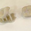 最終補綴・歯冠補綴の３Dプリントについて
