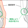 ランナー膝でフルマラソンに出た結果