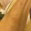 「点滴が外れたその日に──エレベーターで出会った“奇跡の再会”」