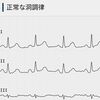 リタイア後の検診②健康グッズ･採血の結果に反省する。