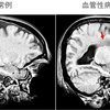 じじぃの「カオス・地球_427_2035年に生き残る企業・第1章・生成AI・画像診断」