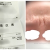 【湘南美容】激安4990円！眉間シワ取りボトックス(アラガン)打ってみた