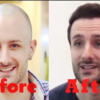 The actionable tips for hairpieces for men