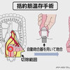 排便機能障害で排便サイクルを知る手がかり