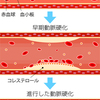 わかった！善玉コレステロールが高い人は認知症を発症しにくい。