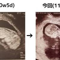 ２度の 胎児ドック を終えて １６ｗ妊娠５ヵ月の記録 ゆーんの徒然日記