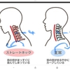 上が向けない。。肩が凝る理由