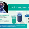 What are Key Factors Causing Boom of Brain Implant Market? 