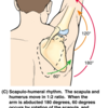 Overpronation Of The Foot