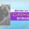 「エンテロウイルスD６８」　今年は日本で９４件、２０１４年は９件！