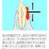 歯石を取ってもらうの事。